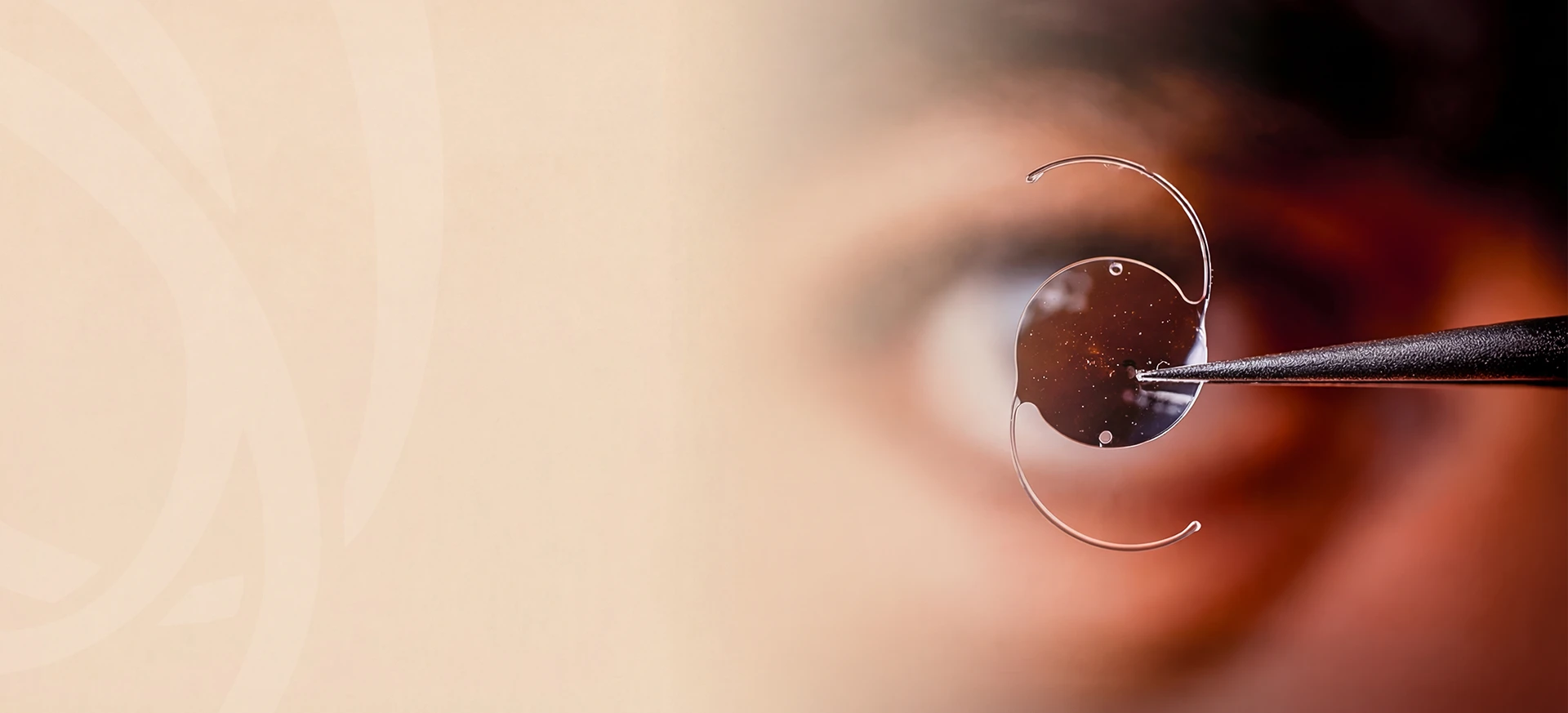Detalhe de lente intraocular